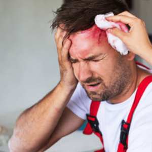 facial trauma